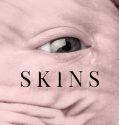 Skins (2017)Skins (2017)